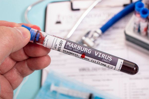 TP.HCM khuyến cáo người dân cảnh giác với Virus Marburg