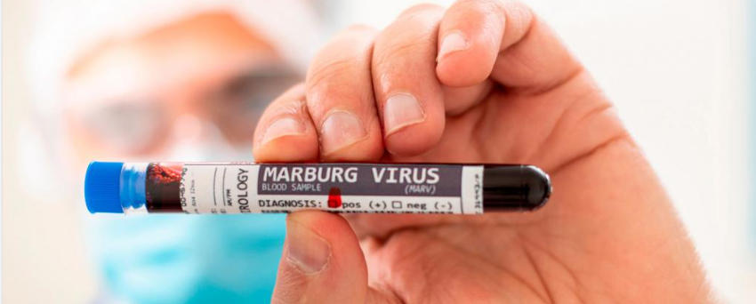 Thêm 5 ca nhiễm virus Marburg tử vong
