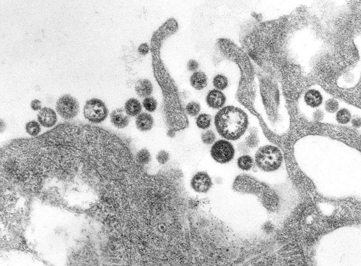 10 người ở Nigeria tử vong do bệnh sốt xuất huyết ác tính